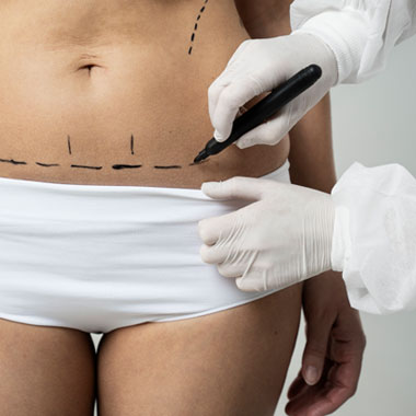 Mulher Abdominoplastia