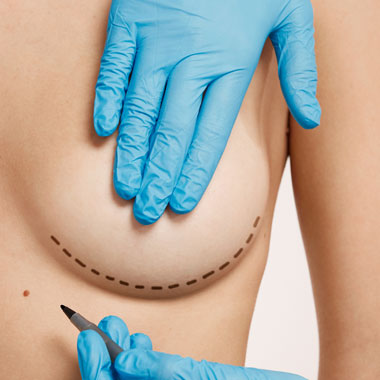 Mulher Mamoplastia